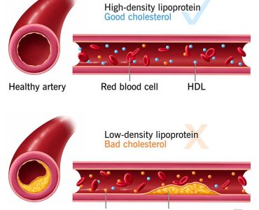 cholesterol
