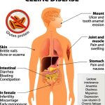 The Agony of Lightning Strikes: Understanding and Managing Cluster Headaches